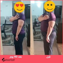 قص المعدة في شيراز | الدكتور مهدي تهمتن