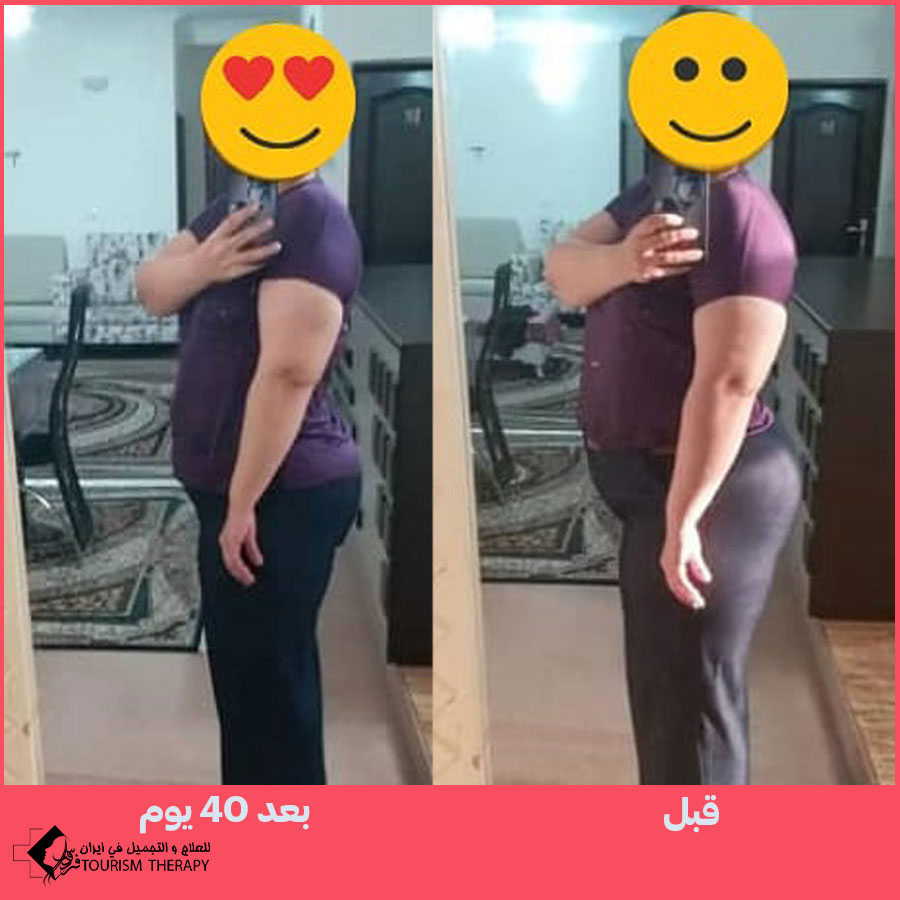 قص المعدة في شيراز | الدكتور مهدي تهمتن
