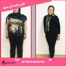 قص المعدة في شيراز | الدكتور محمد رجايي