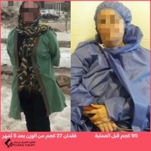 قص المعدة في شيراز | الدكتور مهدي تهمتن