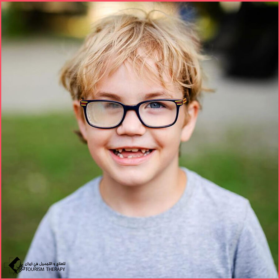 strabismus 3muscles shiraz دكتور عملية الحول في مستشفى مير حسيني