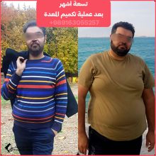 أفضل دكتور قص المعدة في شيراز | د. سيد ناصر افشين